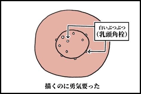 かす 乳首|乳頭に溜まる白い垢のようなものについて 